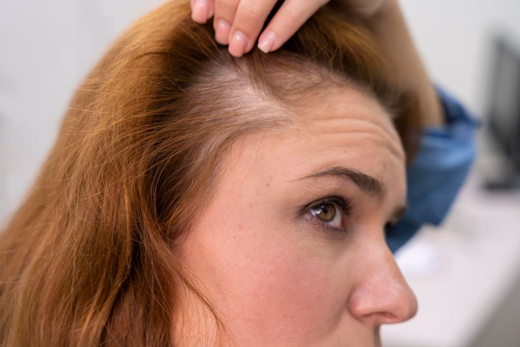 HRT for Hair Loss: A Guide to Regrowth