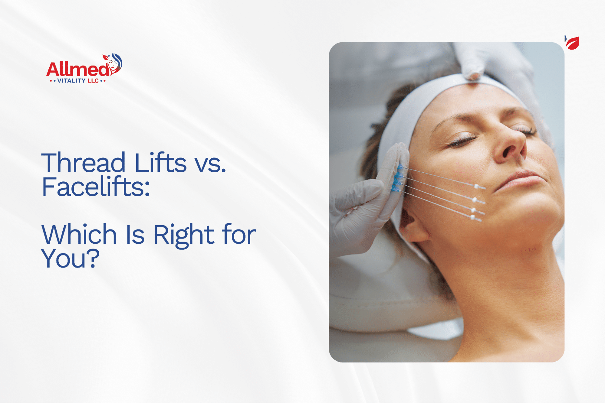 Thread Lifts vs. Facelifts: Which Is Right for You?