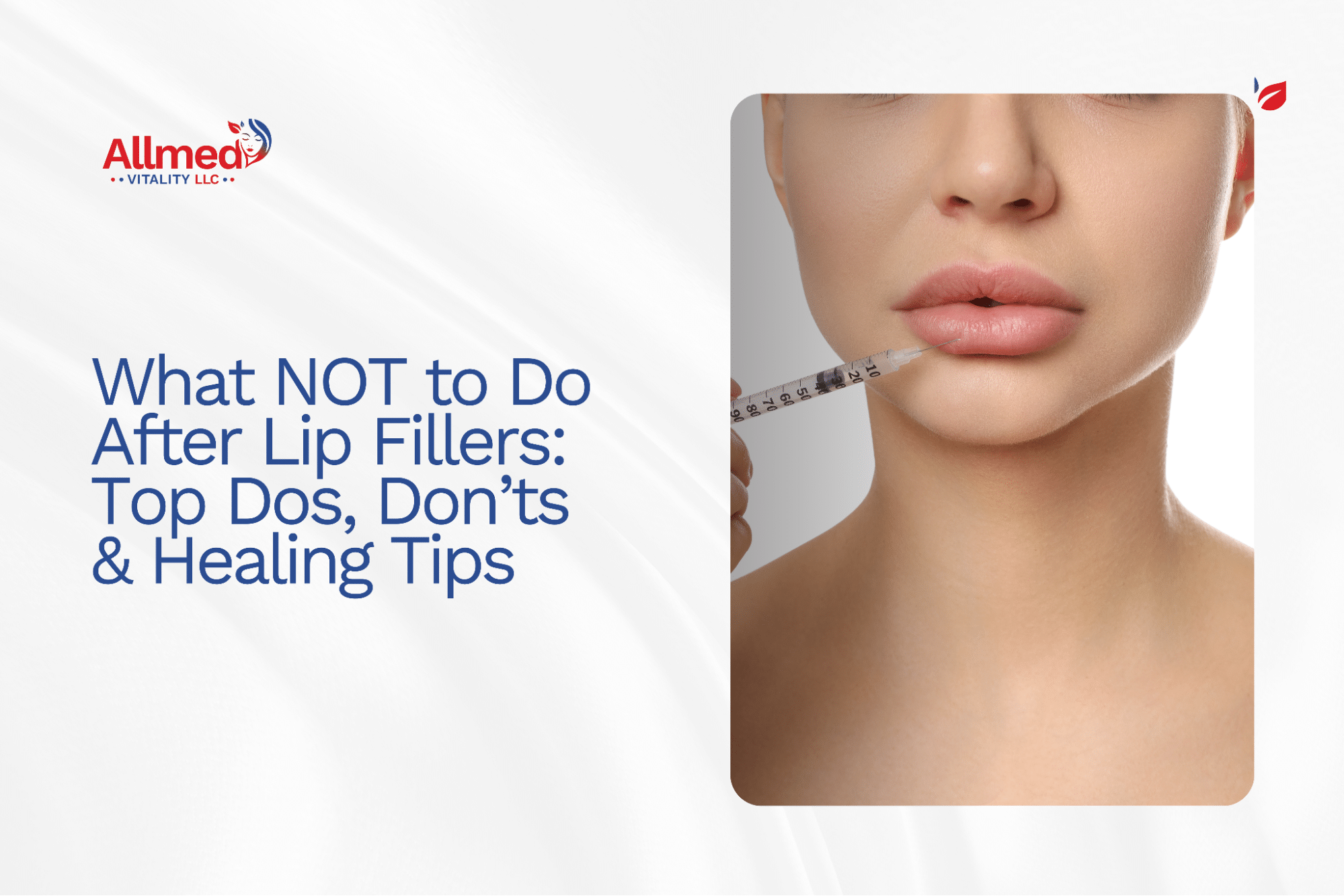 What NOT to Do After Lip Fillers: Top Do’s, Don’ts & Healing Tips